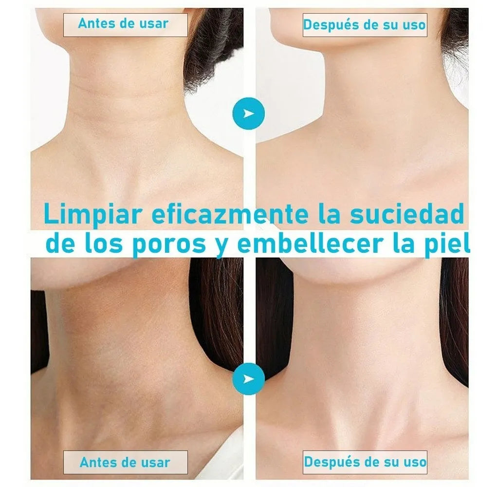 Máquina Reafirmante Facial Y Cuello EMS